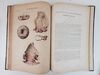 ANATOMIE PATHOLOGIQUE DU CORPS HUMAIN, OU DESCRIPTIONS, AVEC FIGURES LITHOGRAPHIEES ET COLORIEES, DES DIVERSES ALTERATIONS MORBIDES DONT LE CORPS HUMAIN EST SUSCEPTIBLE [Excerpts]