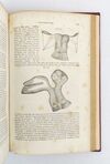 ELEMENTS OF PATHOLOGICAL ANATOMY; ILLUSTRATED BY COLORED ENGRAVINGS AND TWO HUNDRED FIFTY WOODCUTS