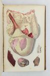 PRINCIPLES OF PATHOLOGICAL ANATOMY: ADAPTED TO THE CYCLOPEDIA OF PRACTICAL MEDICINE AND ANDRAL'S ELEMENTS. WITH TWO HUNDRED AND SIXTY BEAUTIFULLY COLORED ILLUSTRATIONS