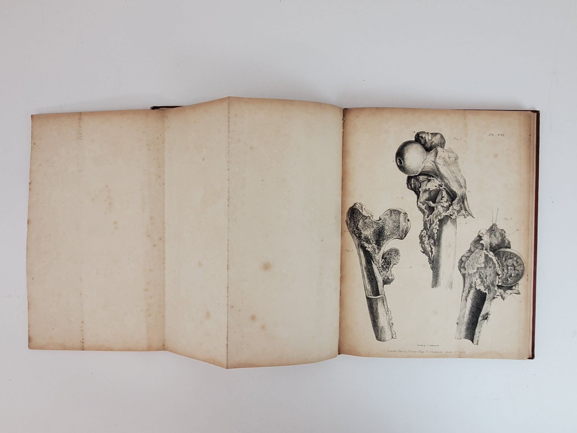 Product Image for OBSERVATIONS ON INJURIES OF THE SPINE AND OF THE THIGH BONE: IN TWO LECTURES, DELIVERED IN THE SCHOOL OF GREAT WINDMILL STREET
