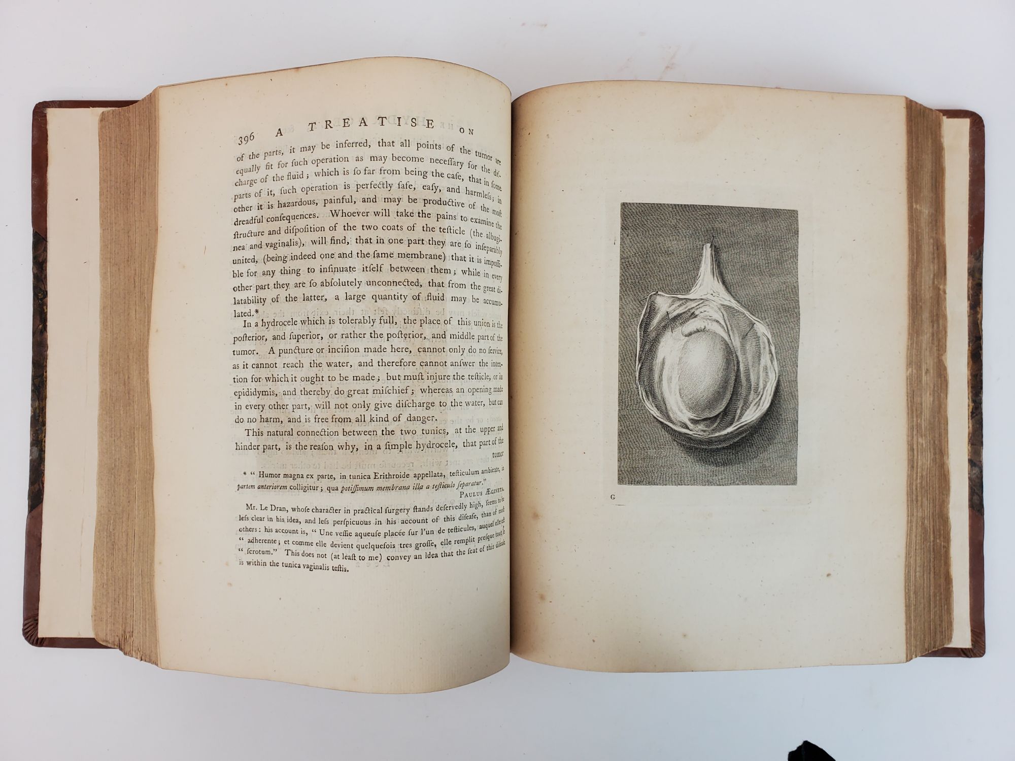 Product Image for THE CHIRURGICAL WORKS OF PERCIVALL POTT