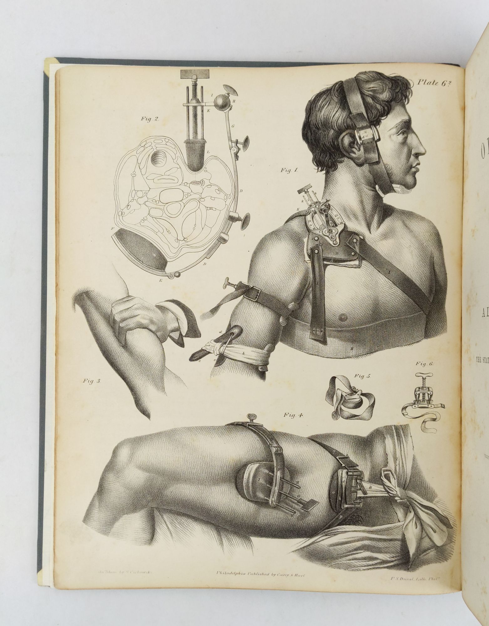 Product Image for A TREATISE ON OPERATIVE SURGERY; COMPRISING A DESCRIPTION OF THE VARIOUS PROCESSES OF THE ART, INCLUDING ALL THE NEW OPERATIONS ; EXHIBITING THE STATE OF SURGICAL SCIENCE IN ITS PRESENT ADVANCED CONDITION: WITH EIGHTY PLATES CONTAINING FOUR HUNDRED AND EI