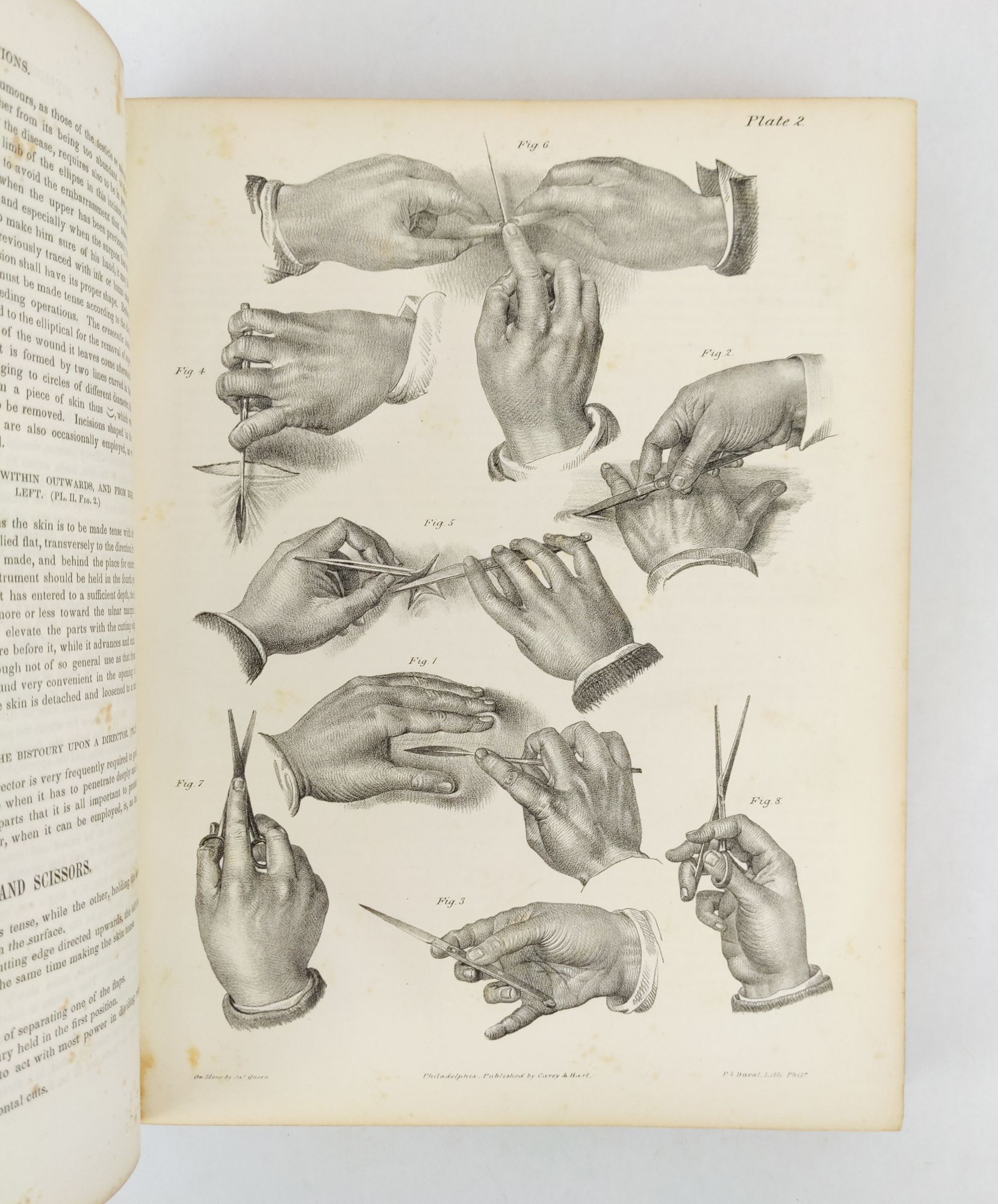 Product Image for A TREATISE ON OPERATIVE SURGERY; COMPRISING A DESCRIPTION OF THE VARIOUS PROCESSES OF THE ART, INCLUDING ALL THE NEW OPERATIONS ; EXHIBITING THE STATE OF SURGICAL SCIENCE IN ITS PRESENT ADVANCED CONDITION: WITH EIGHTY PLATES CONTAINING FOUR HUNDRED AND EI