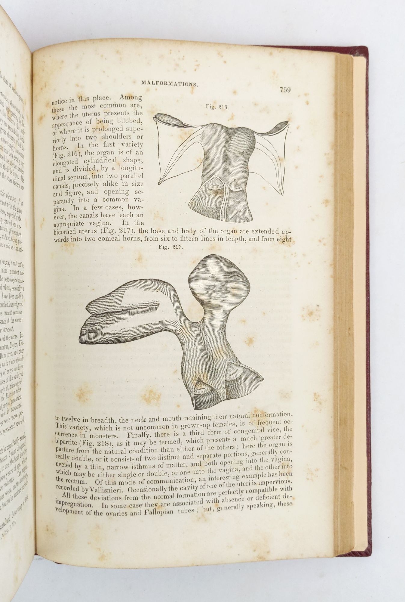 Product Image for ELEMENTS OF PATHOLOGICAL ANATOMY; ILLUSTRATED BY COLORED ENGRAVINGS AND TWO HUNDRED FIFTY WOODCUTS