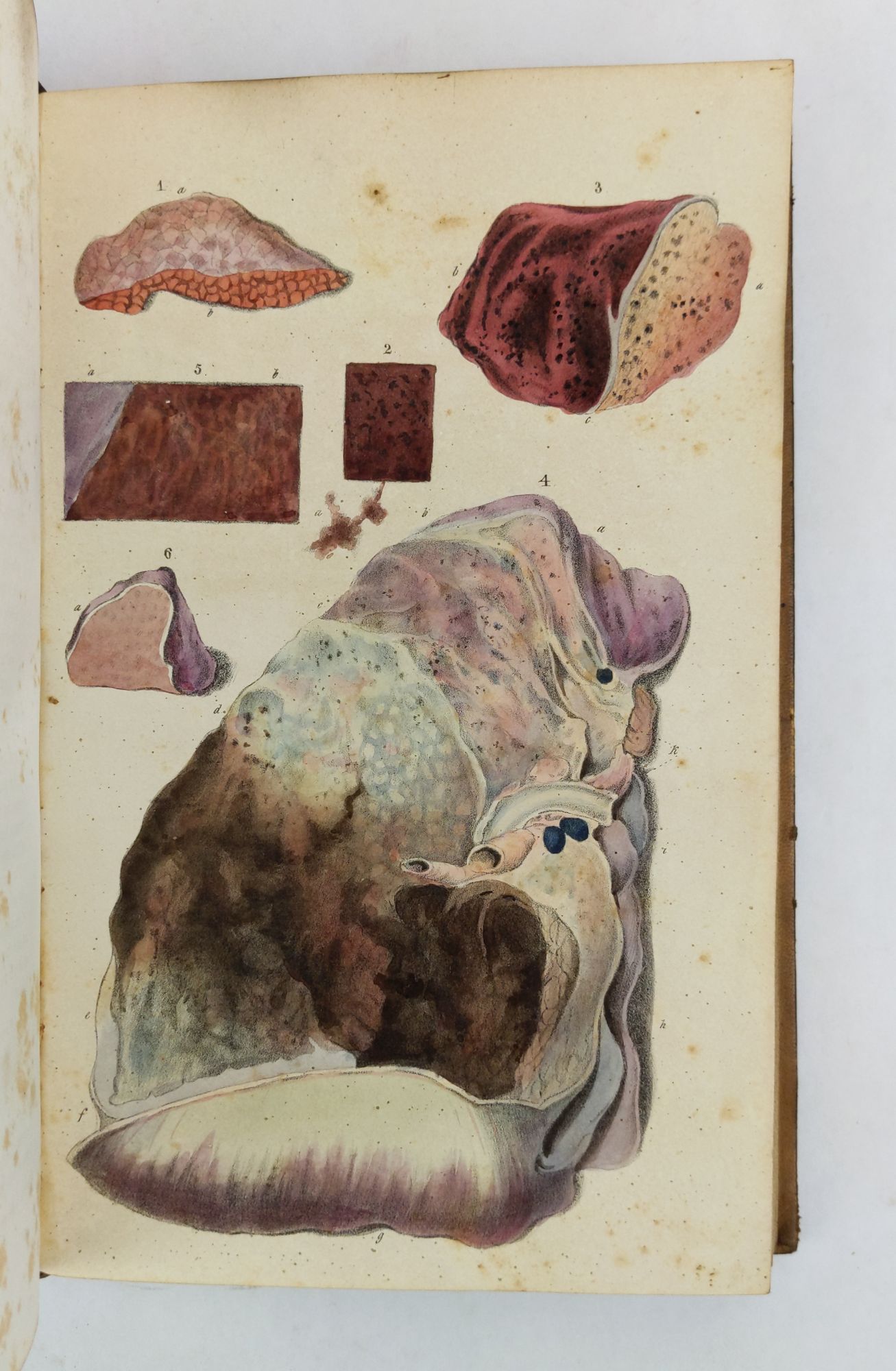 Product Image for PRINCIPLES OF PATHOLOGICAL ANATOMY: ADAPTED TO THE CYCLOPEDIA OF PRACTICAL MEDICINE AND ANDRAL'S ELEMENTS. WITH TWO HUNDRED AND SIXTY BEAUTIFULLY COLORED ILLUSTRATIONS