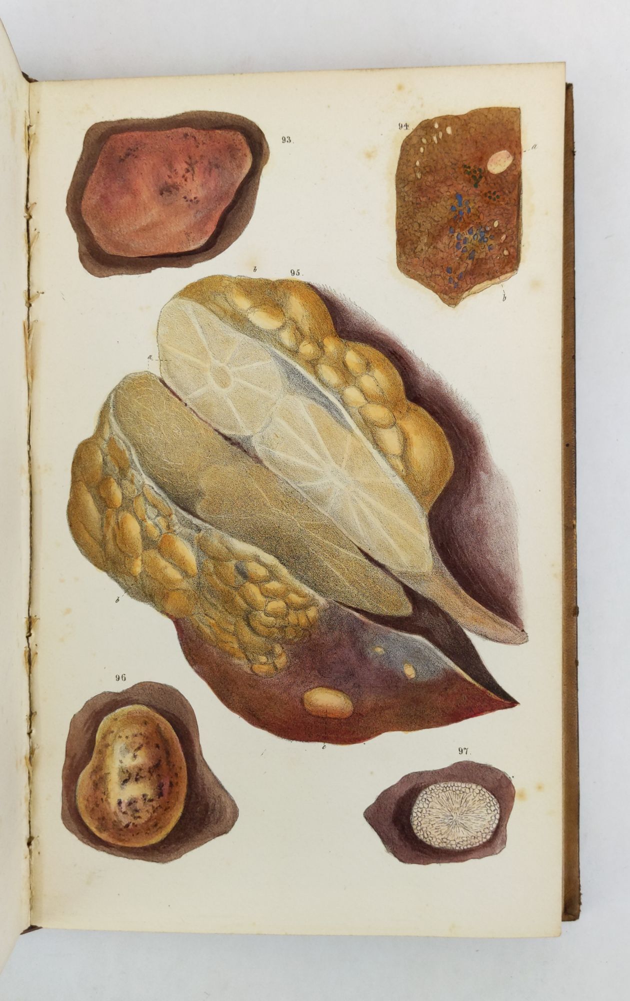 Product Image for PRINCIPLES OF PATHOLOGICAL ANATOMY: ADAPTED TO THE CYCLOPEDIA OF PRACTICAL MEDICINE AND ANDRAL'S ELEMENTS. WITH TWO HUNDRED AND SIXTY BEAUTIFULLY COLORED ILLUSTRATIONS